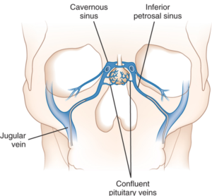 Inferior Petrosal Sinus Sampling